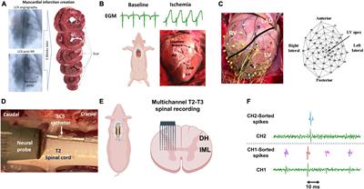 Spinal neuromodulation mitigates myocardial ischemia-induced sympathoexcitation by suppressing the intermediolateral nucleus hyperactivity and spinal neural synchrony